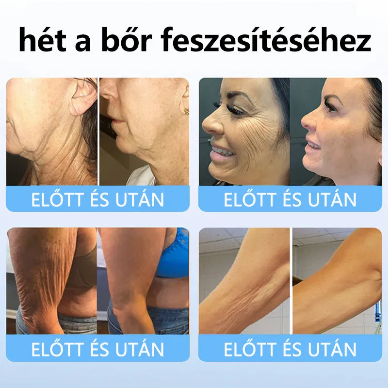 Bara de esență de îmbunătățire a peptidelor de colagen